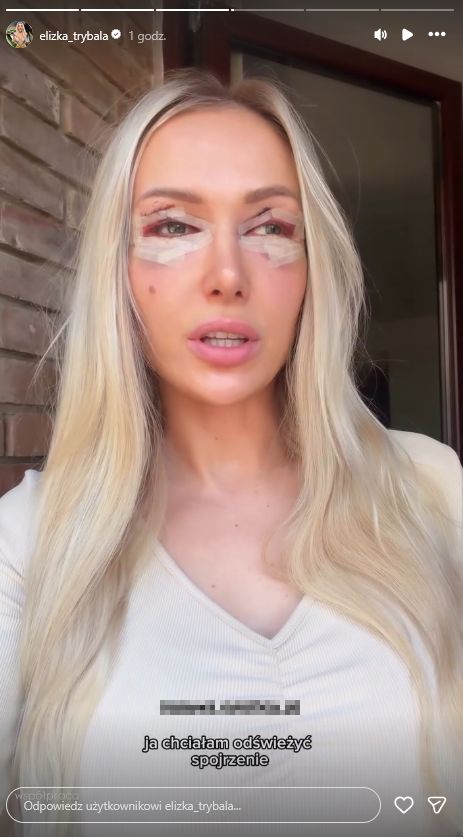 Eliza Trybała zafundowała sobie plastykę powiek