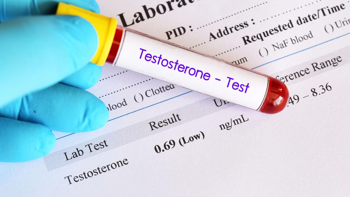 Testosteron to hormon syntetyzowany głównie przez jądra, a oprócz tego również przez nadnercza (u mężczyzn i u kobiet), a także jajniki
