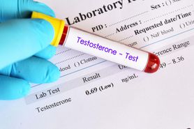 Testosteron - rola, badanie, nadmiar, niedobór