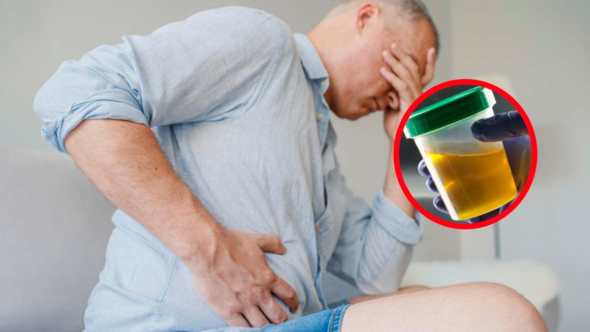 Zwróć uwagę na kolor. Tak może objawiać się rak trzustki