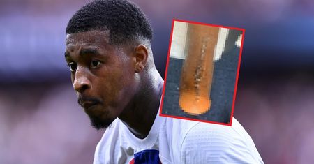 Jak Frankenstein. Piłkarz PSG pokazał nogę po operacji