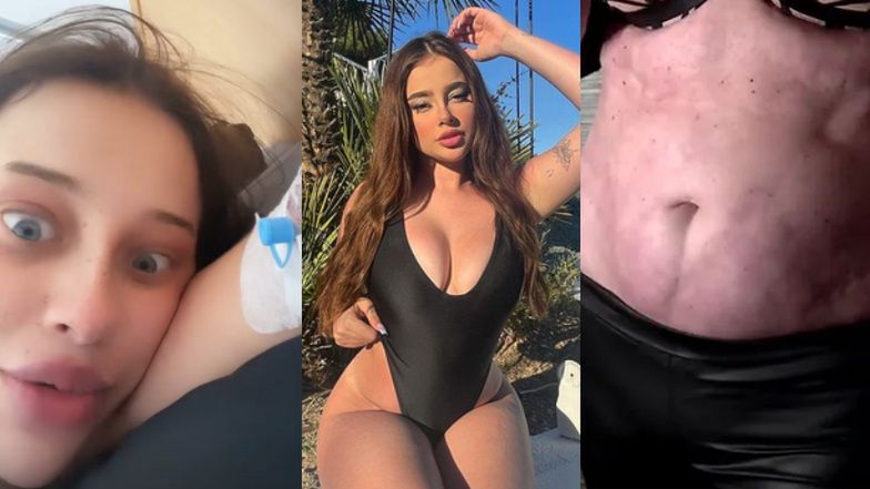 Fagata zrobiła sobie brazylijskie pośladki!