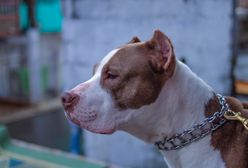 Pitbull zaatakował dziewczynkę. Cudem przeżyła