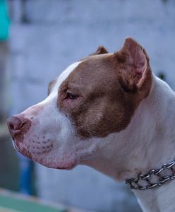 Pitbull zaatakował dziewczynkę. Cudem przeżyła