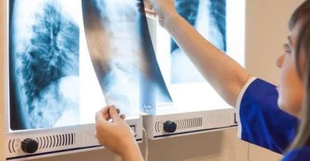 Płatne badanie RTG? Błąd przychodni i szpitala w Bydgoszczy. "Pacjent nie może być za to karany"