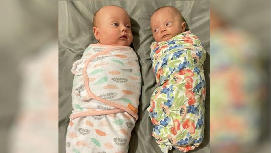 Urodziła wyjątkowe bliźnięta. Lekarze mówią, że to cud
