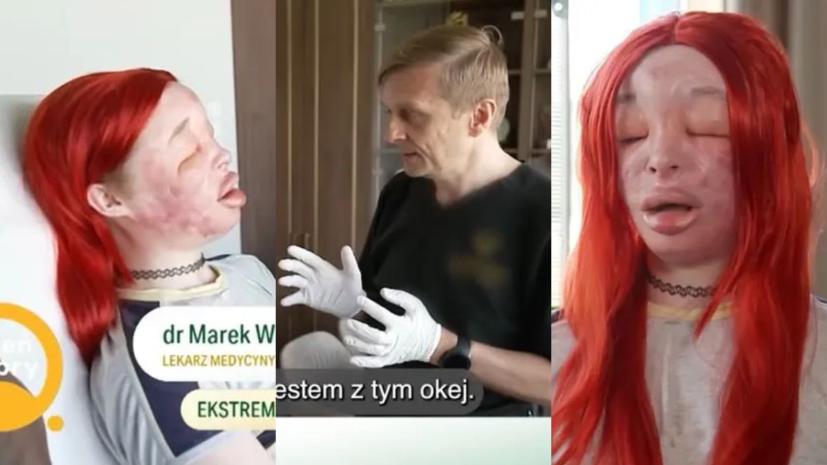Nowe informacje o stanie zdrowia Elvy