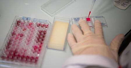Kolejny objaw koronawirusa? Ustalenia naukowców z Londynu
