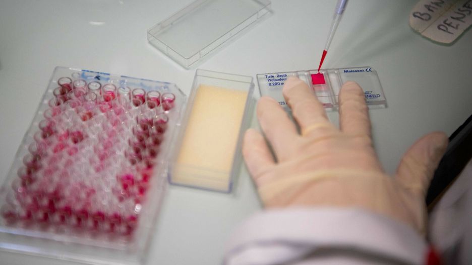 Koronawirus. Kolejny objaw COVID-19? Ustalenia naukowców z Londynu