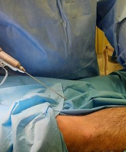 Bielsko-Biała. Szpital ma nowy sprzęt, bezpieczniejsze operacje