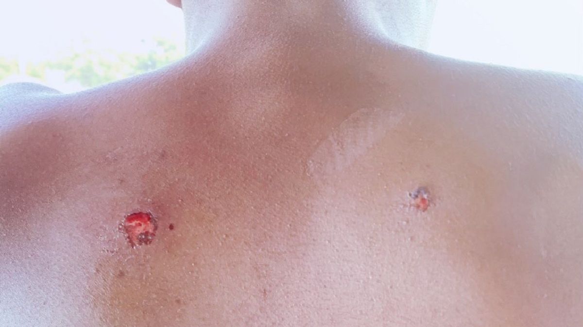 postrzelony nastolatek