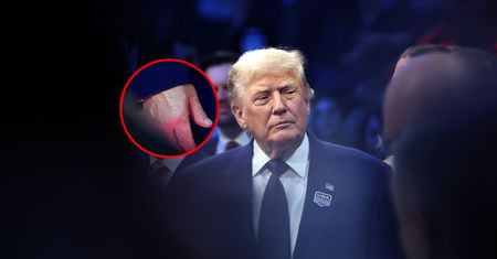 Zwrócił uwagę na dłoń Trumpa. Od razu ruszyły spekulacje