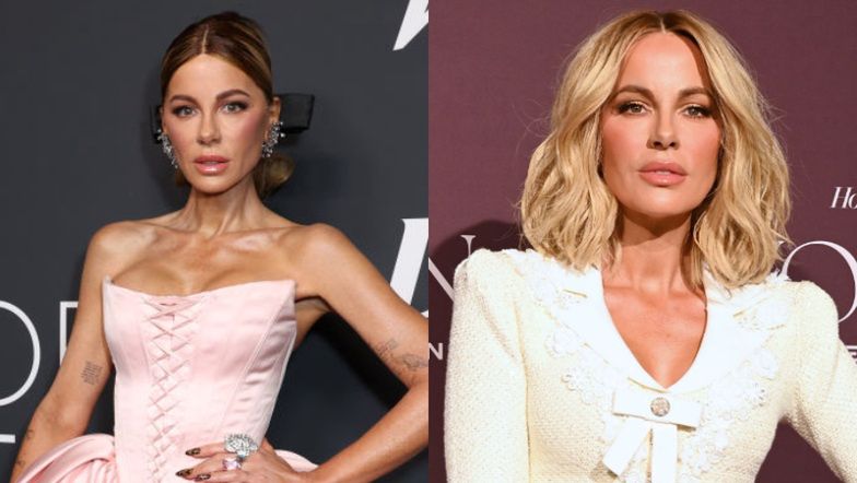 Fani zaniepokojeni wyglądem NOWEJ TWARZY Kate Beckinsale. "Nie do poznania". Sprawie przyjrzał się znany chirurg plastyczny