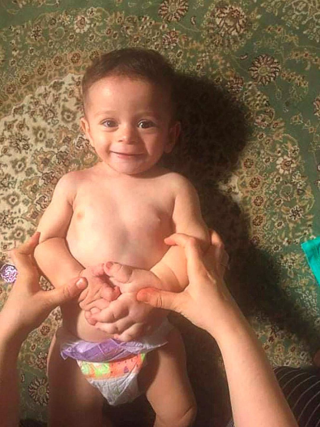 18-miesięczny chłopiec ma dłoń dziecka w wieku 10-lat