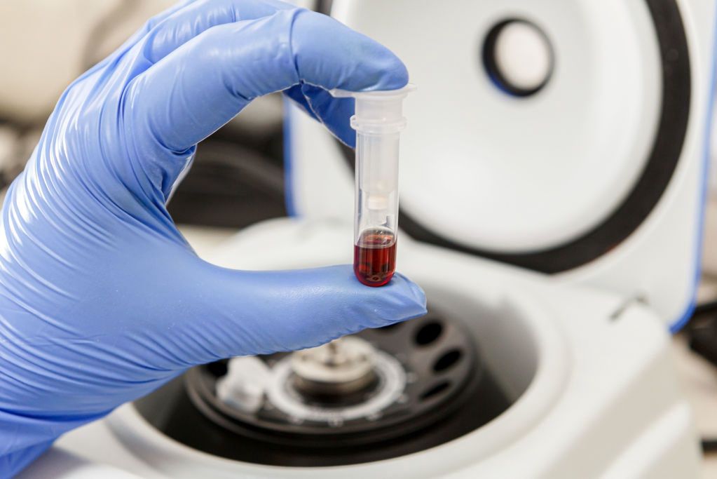 Badanie krwi pozwala na wykrycie 50 rodzajów nowotworów. Ruszają testy - Badanie krwi w laboratorium