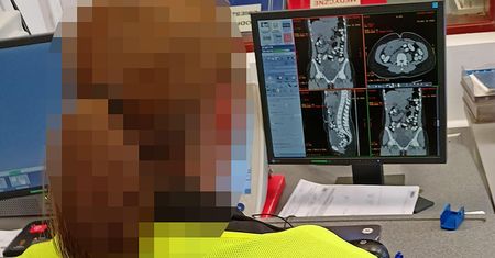 Na lotnisku Chopina zatrzymano kobietę. W żołądku narkotyki, są zdjęcia