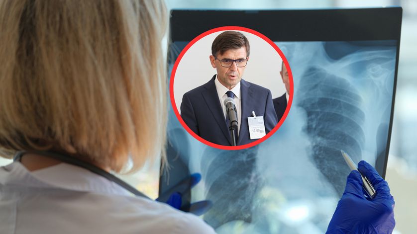 Dr Kuchar: Pneumokoki wywołują najwięcej zachorowań i zgonów