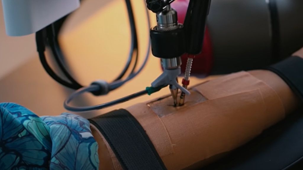 Rewolucja w świecie tatuażu 