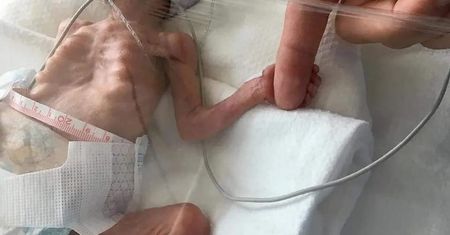 Urodził się trzy miesiące przed terminem. "Nie wierzycie w cuda?"