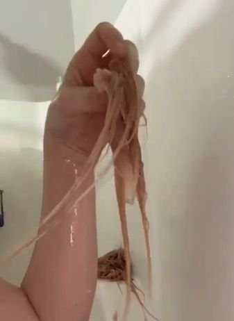 Włosy wychodziły całymi pasmami