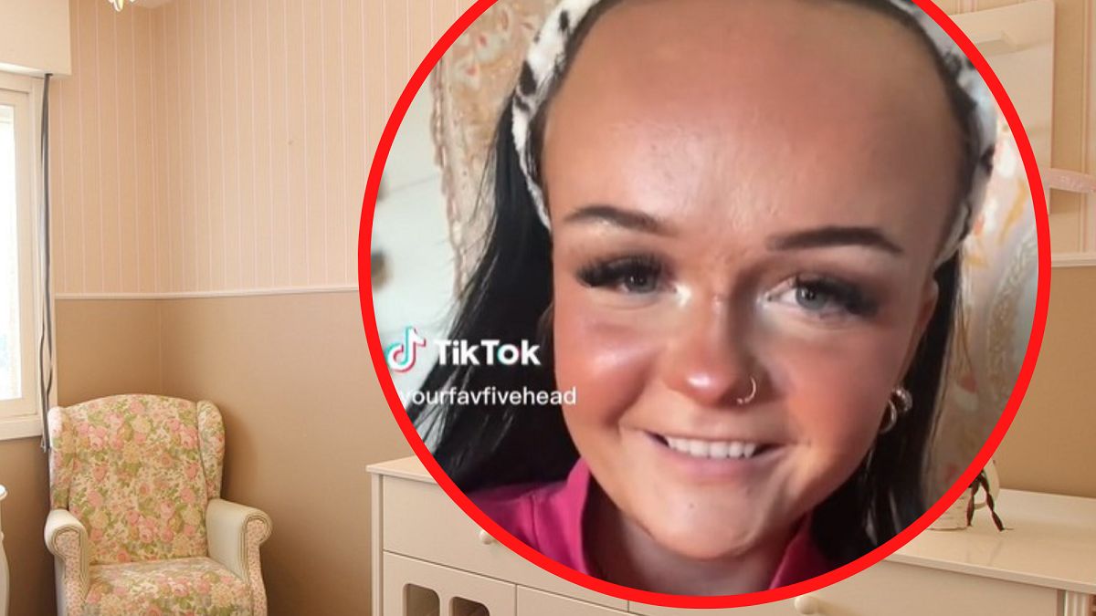 Ludzie dokuczają jej, bo ma wysokie czoło.