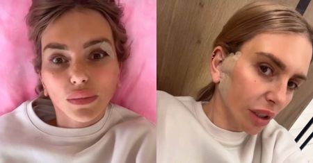 Monika Goździalska zrobiła sobie... lifting brody. "Trochę mam drętwe uszy, ale jest luz"