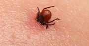 Pamiętaj, gdy kleszcz ugryzie w czasie pracy. Mało znany przepis