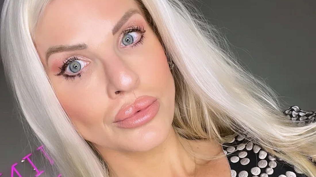 "Spaczona Barbie" urodziła się z wadą rozwojową twarzoczaszki