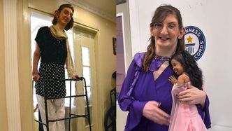 Rumeysa Gelgi jest najwyższą kobietą świata. Z powodu choroby, jako 6-latka, miała już 180 cm wzrostu. Jak wygląda jej życie?