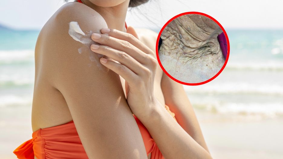 Dermatolożka pokazała skórę 103-letniej pacjentki