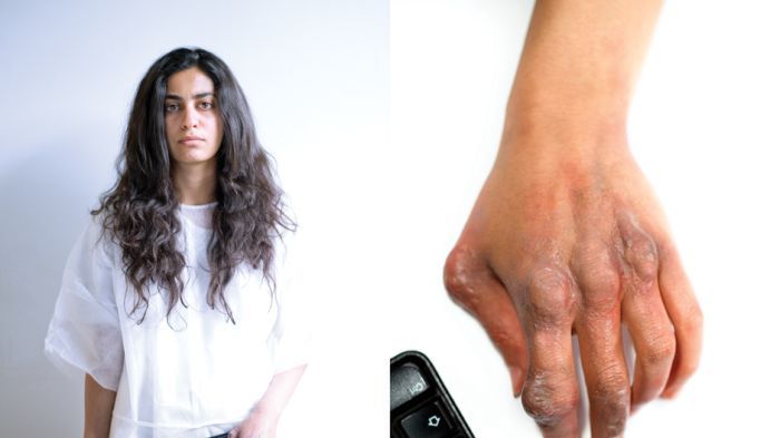 Straszne i nieprawdopodobne efekty używania gadżetów 1