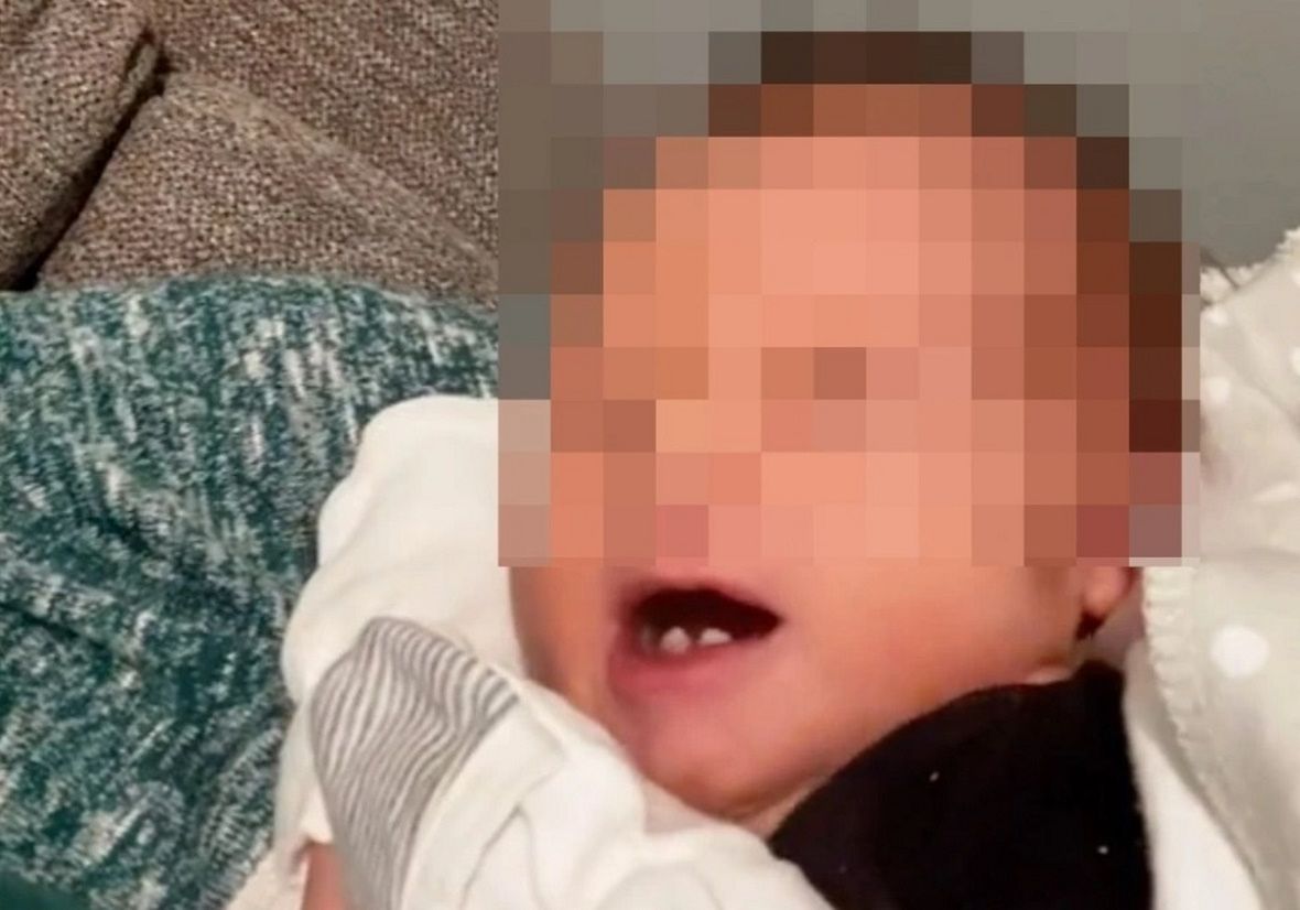 Lekarze twierdzą, że nigdy nie spotkali się z takim przypadkiem