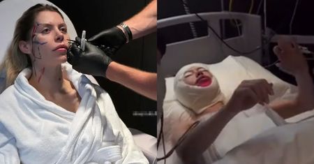 Julia von Stein pokazała się chwilę po wybudzeniu z narkozy. Nie była W STANIE MÓWIĆ! (WIDEO)