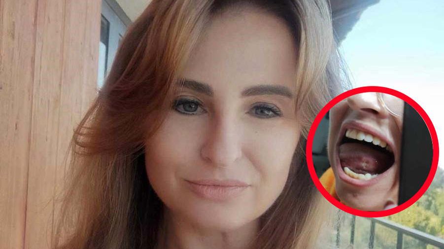 Rak atakował latami. Dopiero laryngolog postawił właściwą diagnozę