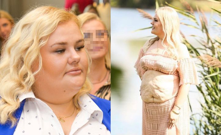 Kinga Zawodnik zaprezentowała brzuch po zrzuceniu 50 kg. Internauta grzmi: "O FUJ, JAK TO WYGLĄDA". Celebrytka odpowiedziała