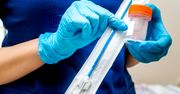 Koniec cytologii na NFZ. Zmiany już od 1 sierpnia