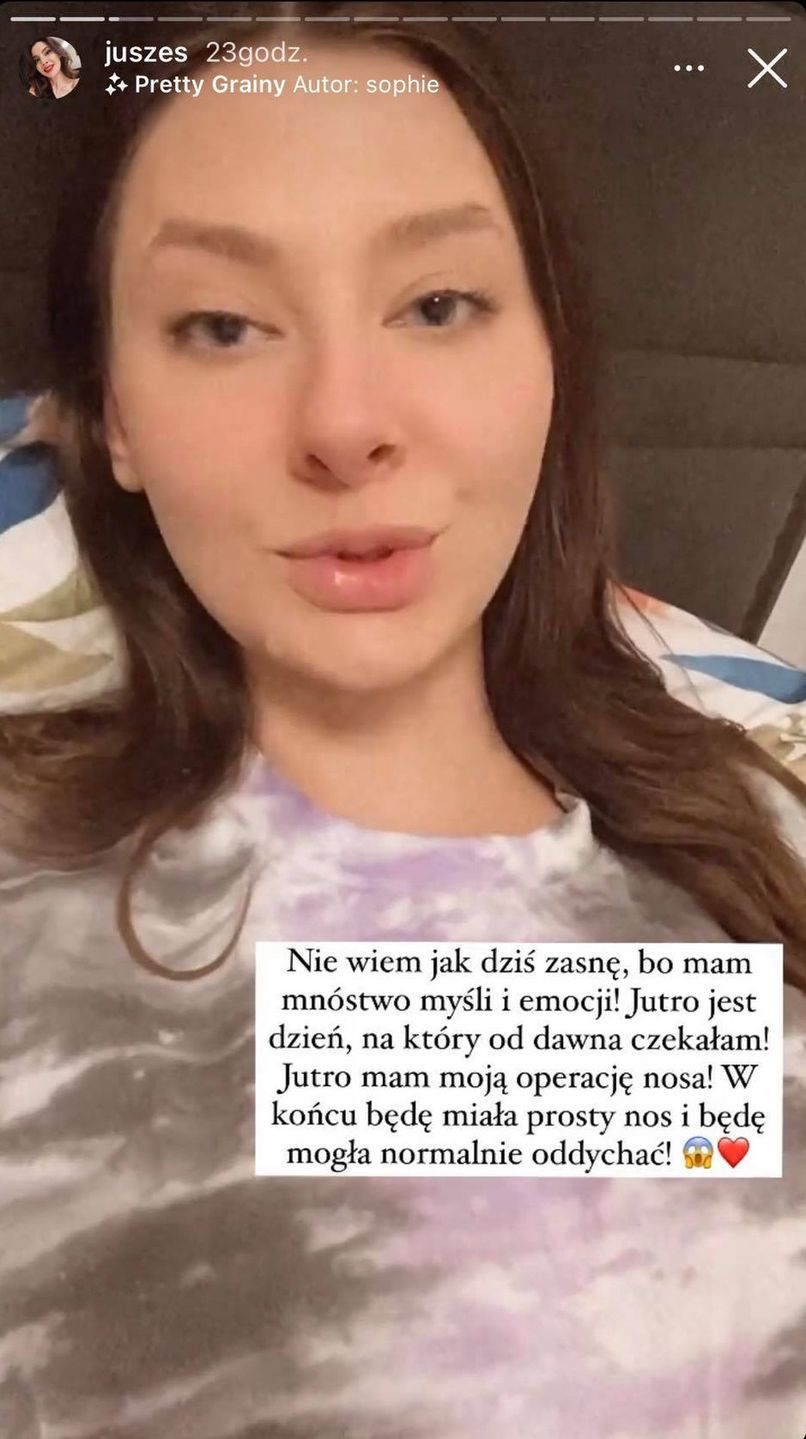 Justyna z "Big Brothera" przeszła operację plastyczną nosa