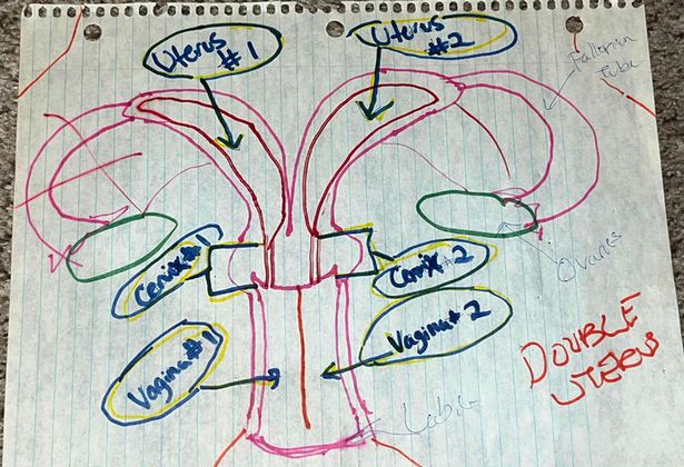 Podwójna macica według Leanne