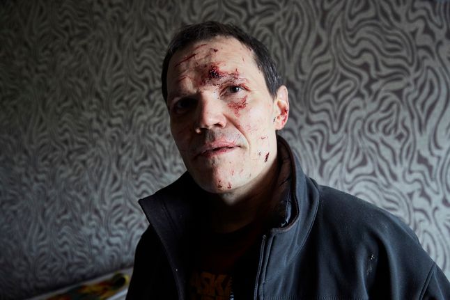 Vladimir został ranny podczas ataku rakietowego na Kijów. Wrócił do zniszczonego mieszkania, by zabrać to, co pozostało.