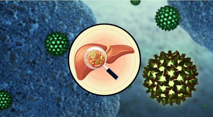 Wirusowe zapalenie wątroby typu A (WZW) - przyczyny, leczenie, epidemia