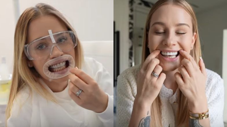 Andziaks chwali się NOWYMI licówkami. "Wyglądają jak szczęka" (WIDEO)