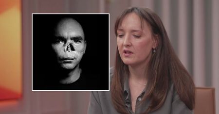 "Dzieci wybuchają płaczem". Ukrainiec stracił na wojnie twarz
