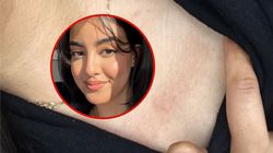 18-latka ciągle ziewała. To był główny objaw raka