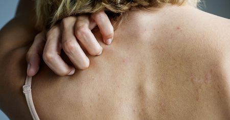 Masz suchą skórę? To może być sygnał, że brakuje ci witaminy D