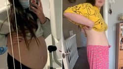 Myśleli, że jest w ciąży. Okazało się, że w brzuchu znajduje się torbiel 