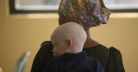 Fragment książki "Nie róbcie mu krzywdy". Filip Skrońc o albinosach
