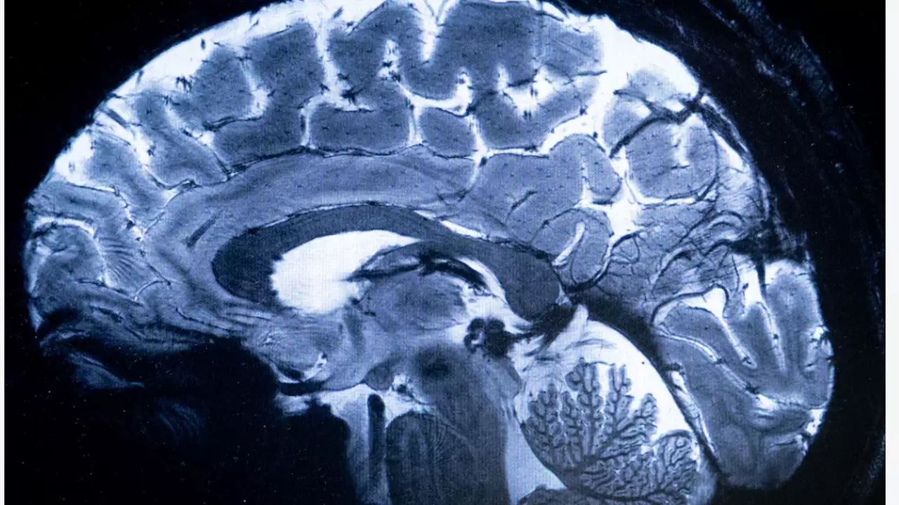 Nowy skaner pozwoli na jeszcze dokładniejsze badania pracy ludzkiego mózgu