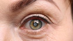 Lekarze z Bielska-Białej wszczepili jej nowatorską soczewkę. Nie musi już nosić okularów