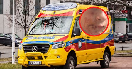 Rzucił się na 6-latka. Koszmarny finał ataku psa pani sołtys