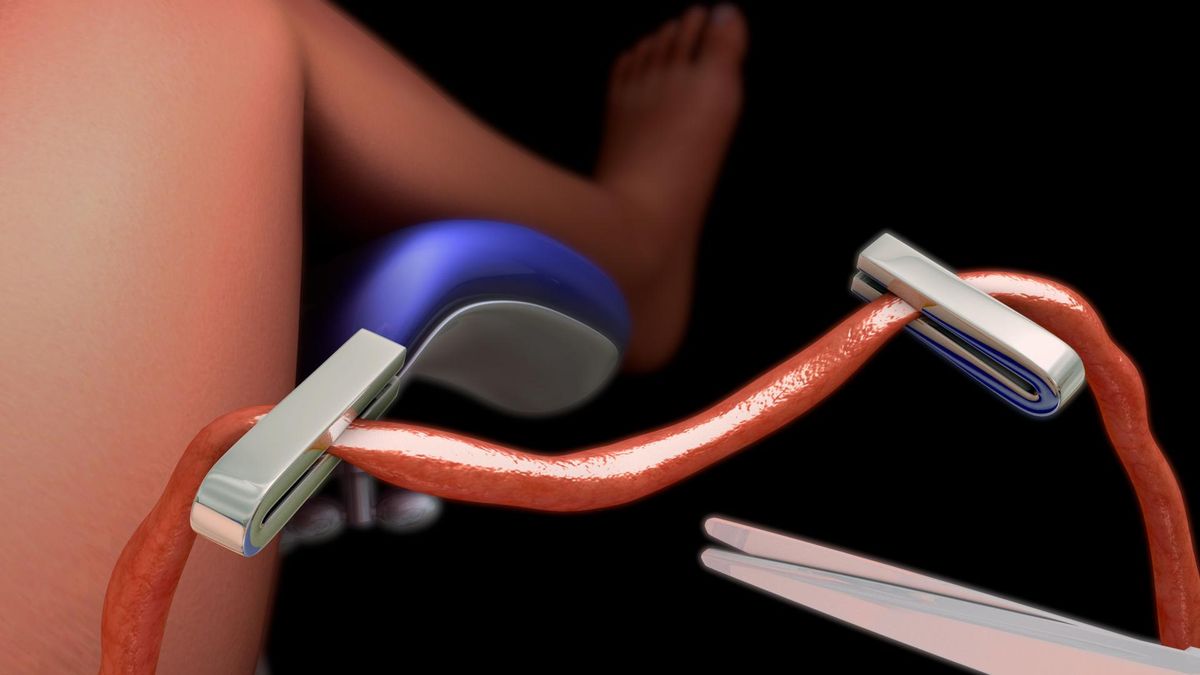 Pępowina – budowa, funkcja